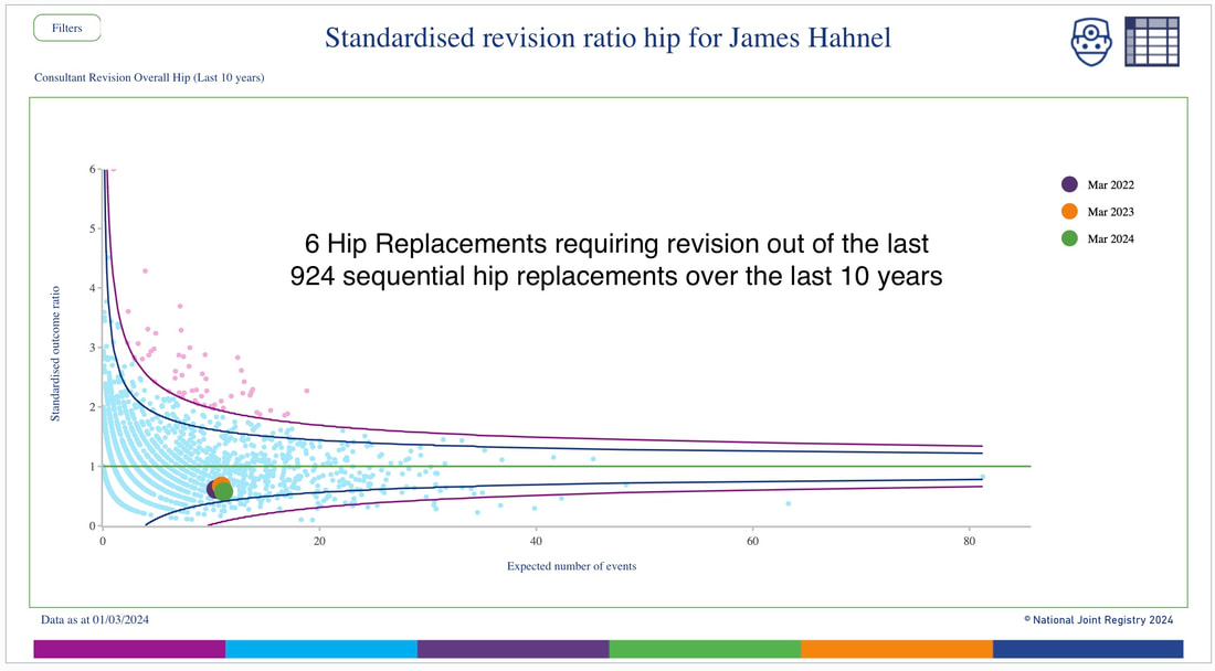 Outcome Data Robotic Hip Surgery Leading hip and knee surgeon James Hahnel