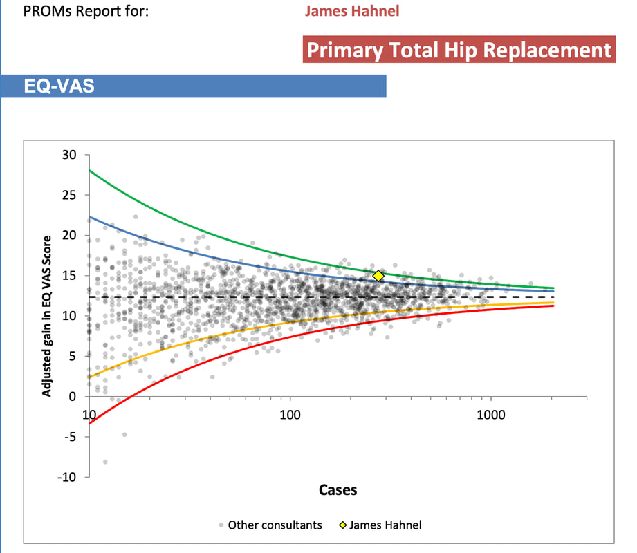 Outcome data robotic hip surgery James Hahnel